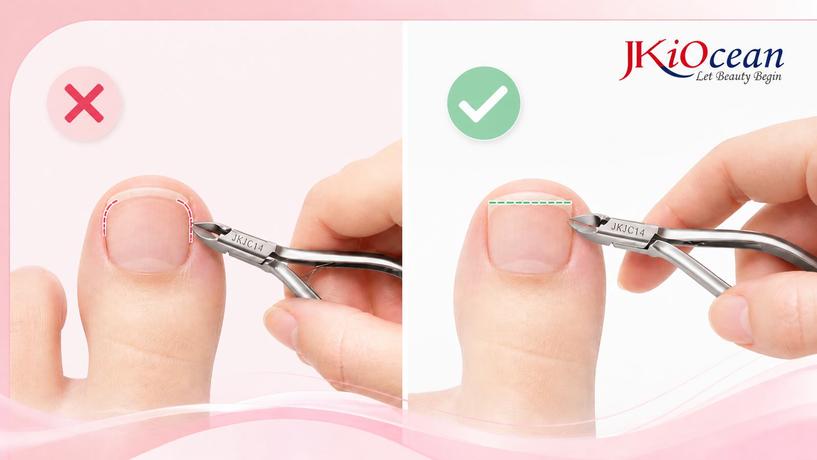 toenail nippers are used to